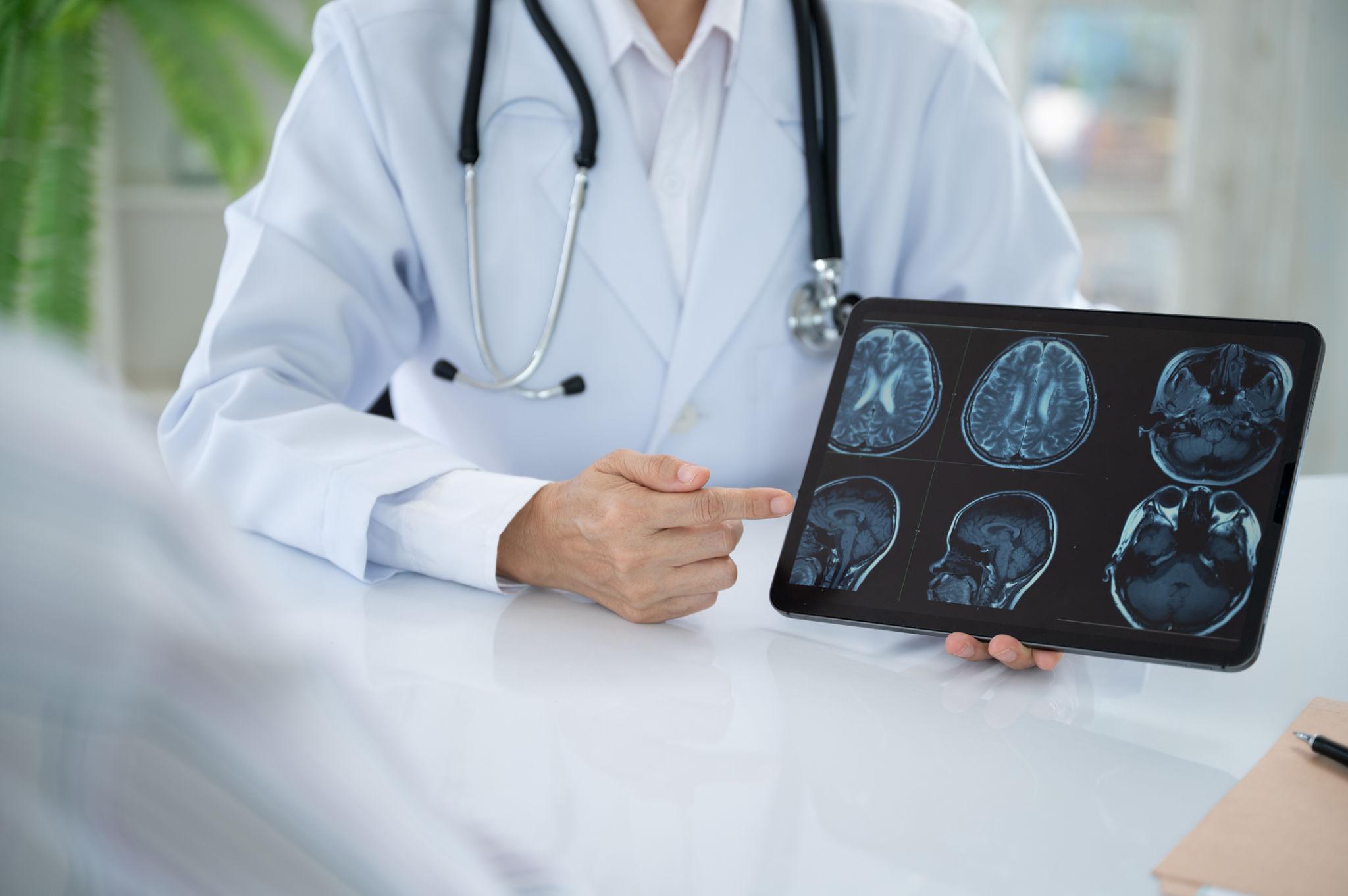 Neurology